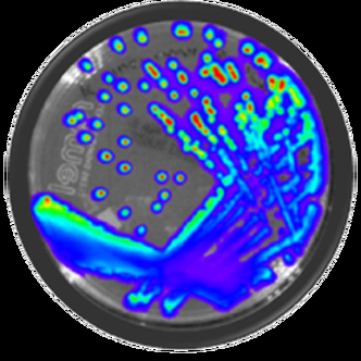 Escherichia coli - Xen 14