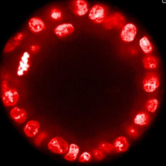 PhenoVue DRAQ5 Total Cell Nuclear Stain, 200 µL