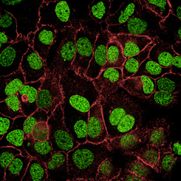 Fluorestseeruvad sekundaarsed antikehad